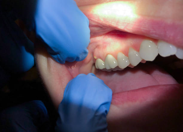 Best Emergency Treatment for Jaw Pain or Injury in Bradley Beach, NJ